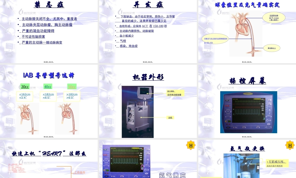 主动脉内球囊反搏泵.ppt