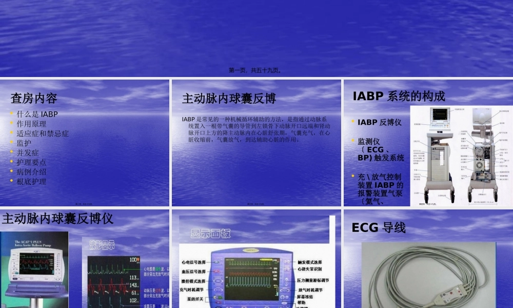 主动脉内球囊反博概述.pptx