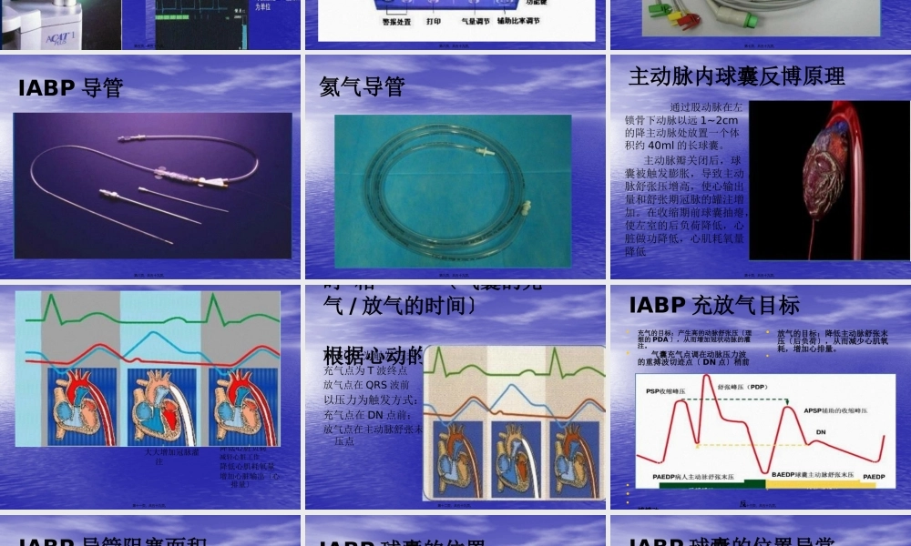 主动脉内球囊反博概述.pptx