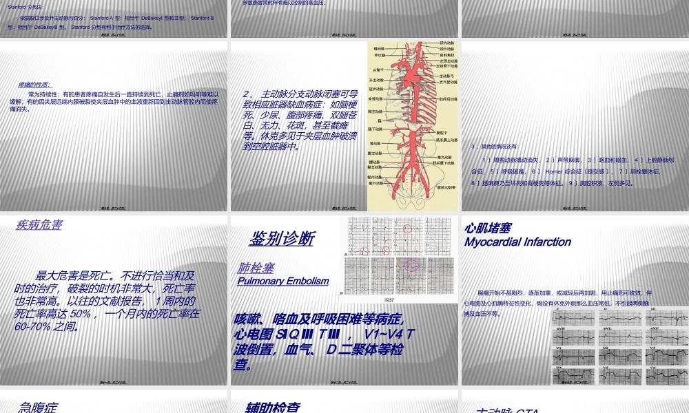 主动脉夹层-ppt.ppt