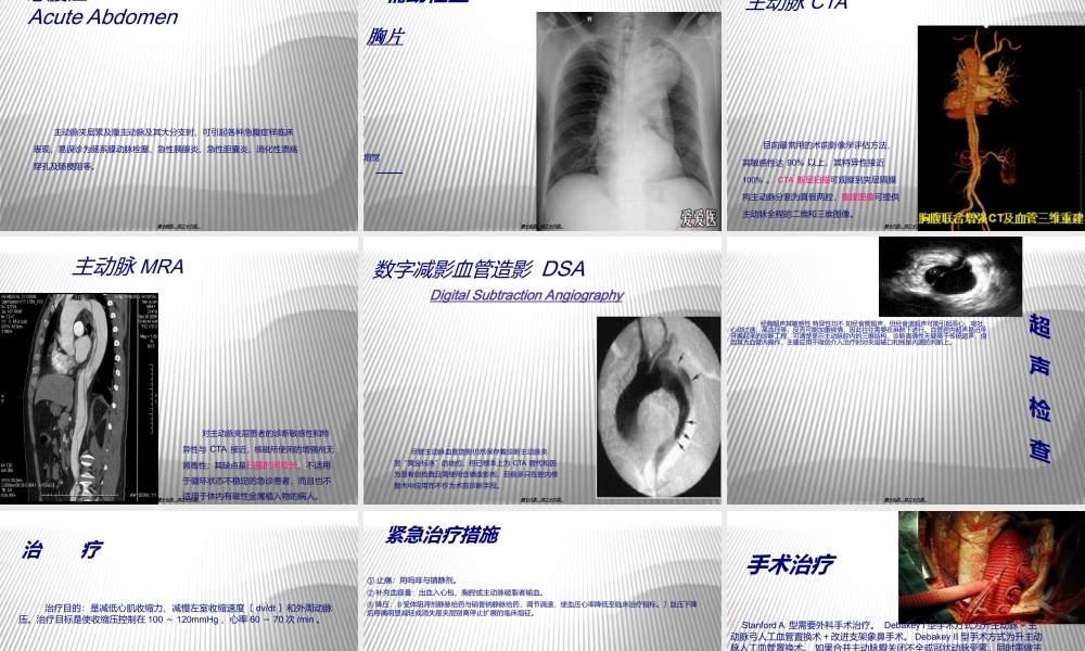 主动脉夹层-ppt.ppt