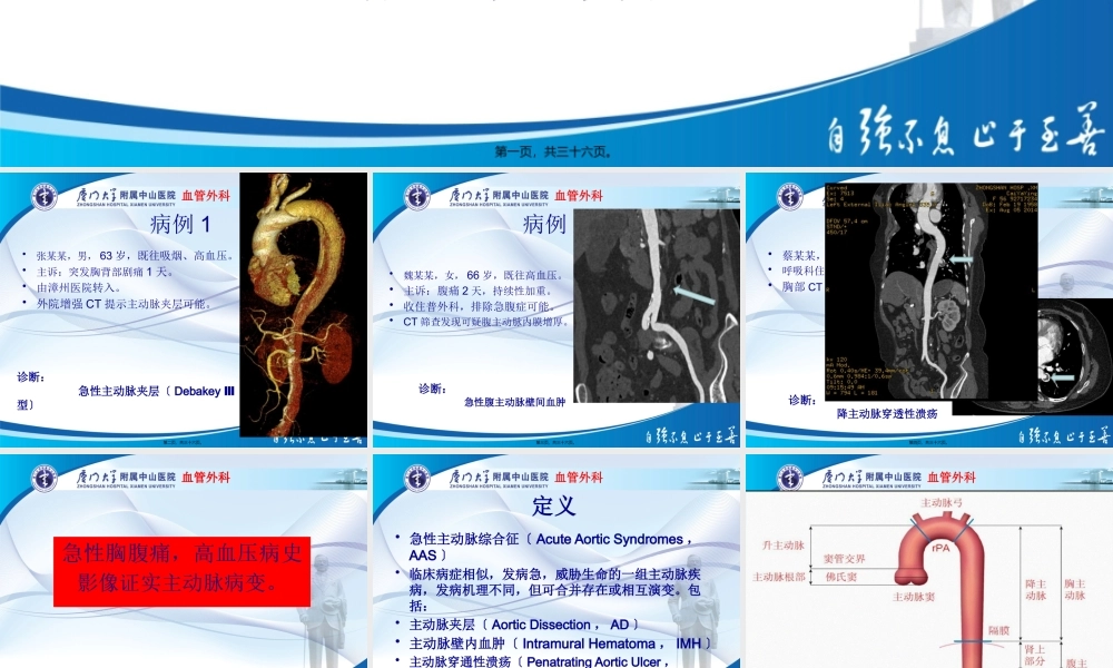 主动脉壁间血肿与穿透性溃疡.pptx