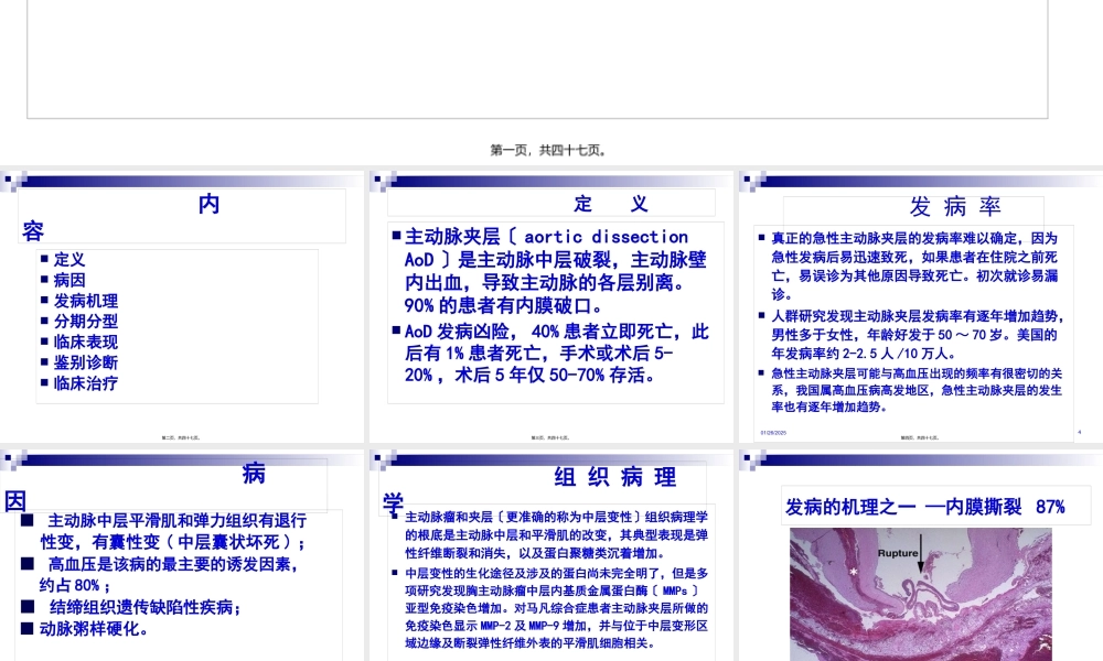 主动脉夹层.jsp.pptx