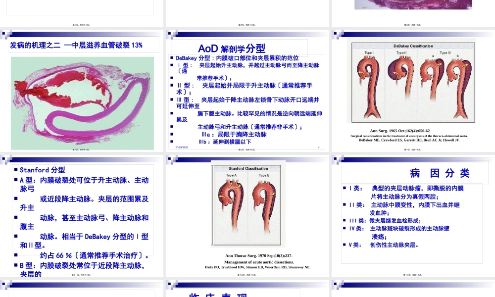 主动脉夹层.jsp.pptx