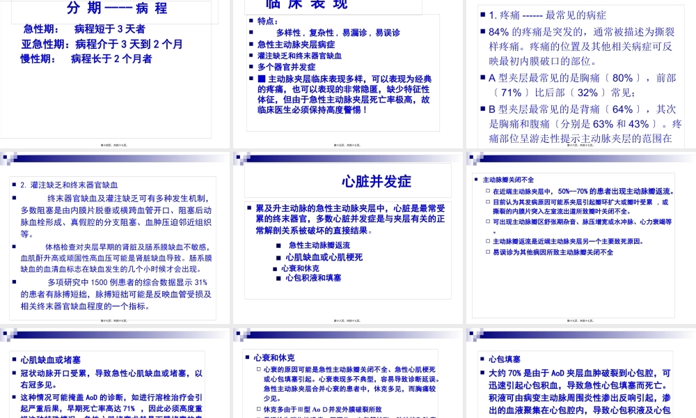 主动脉夹层.jsp.pptx