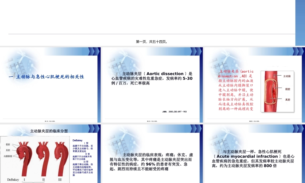 主动脉夹层并急性心肌梗死.pptx