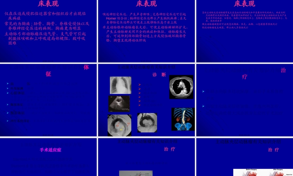 主动脉夹层动脉瘤围手术期教学查房.pptx
