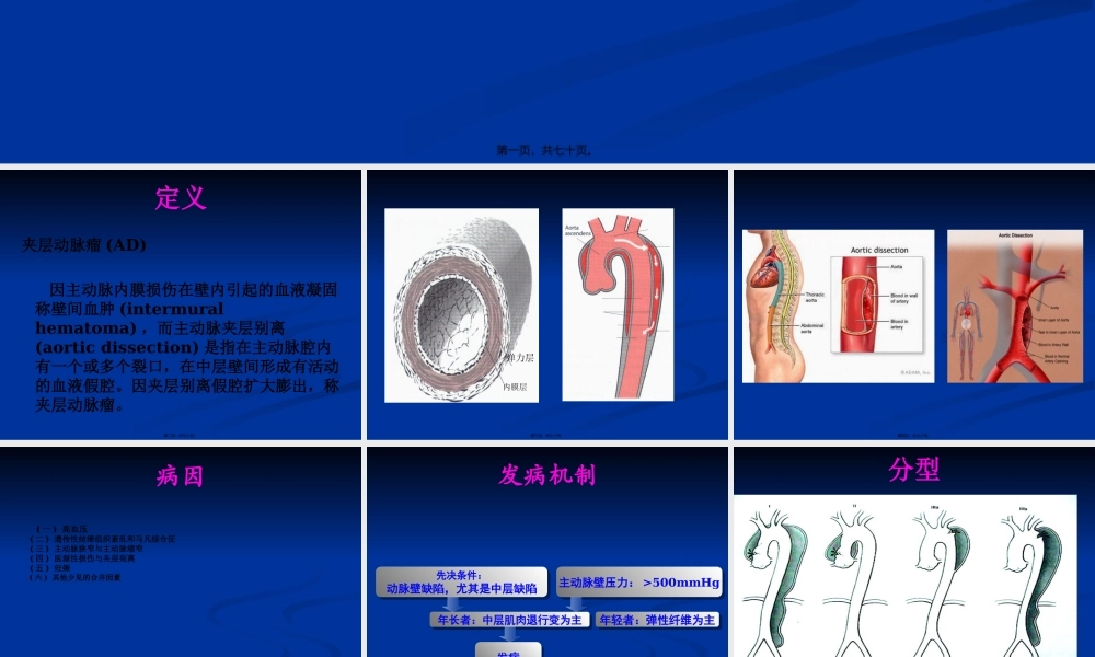 主动脉夹层动脉瘤.pptx
