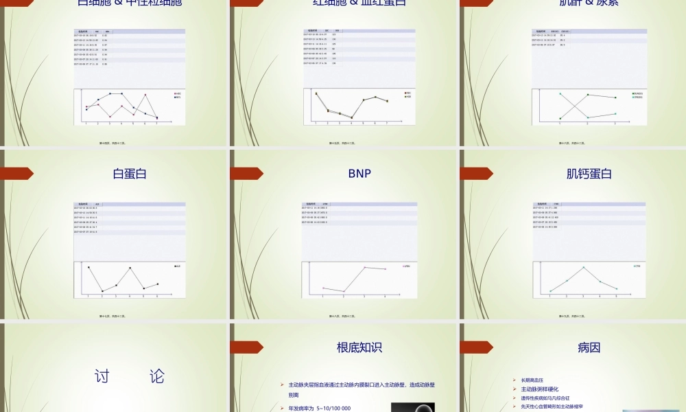 主动脉夹层动脉瘤教学查房.pptx