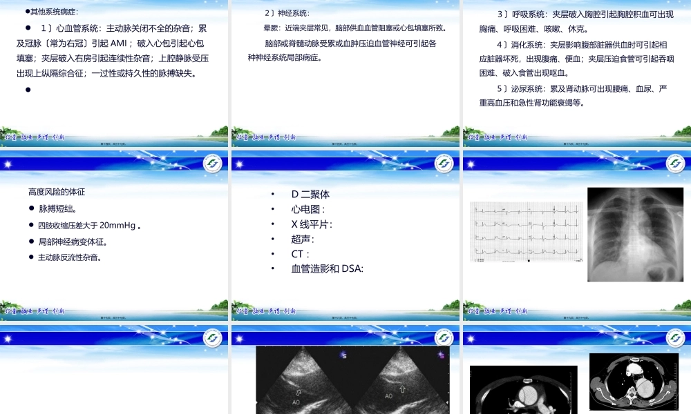 主动脉夹层的诊疗及处理策略.ppt