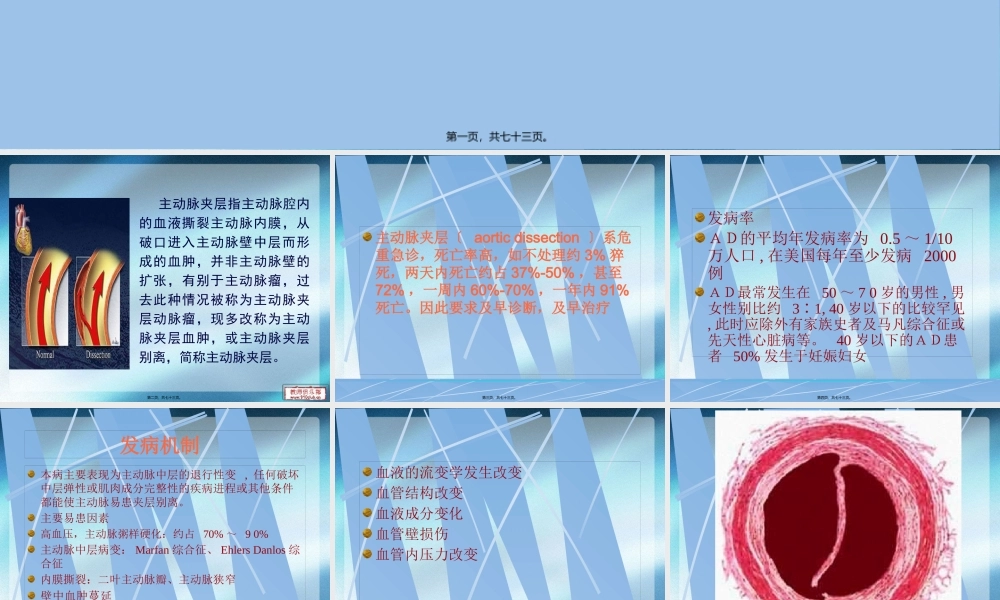 主动脉夹层的诊治.pptx