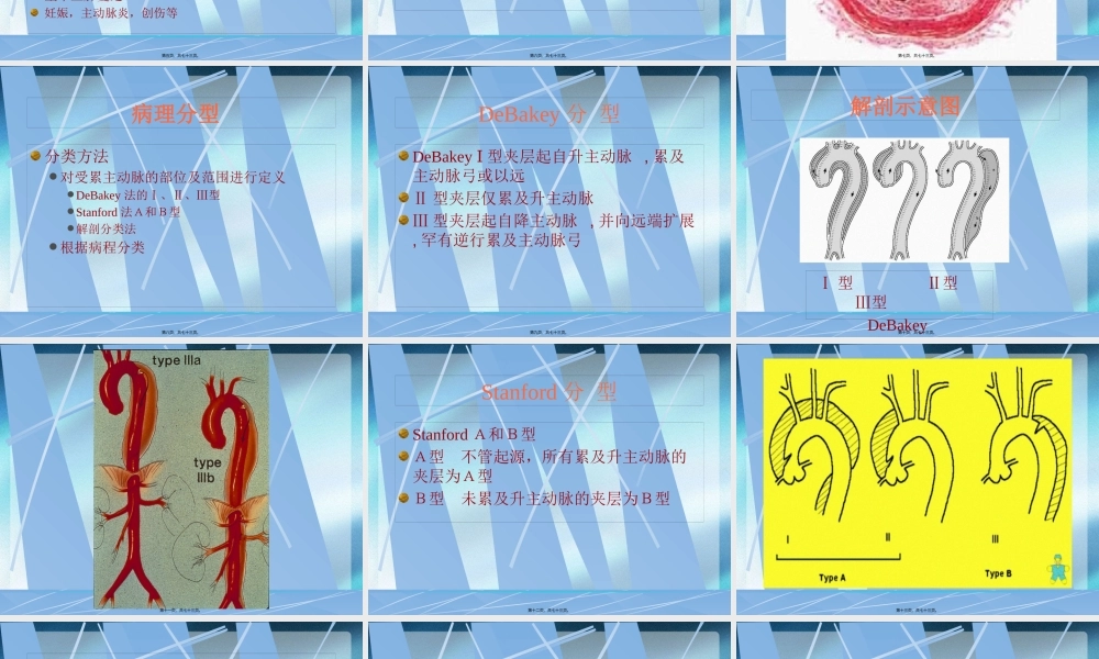 主动脉夹层的诊治.pptx