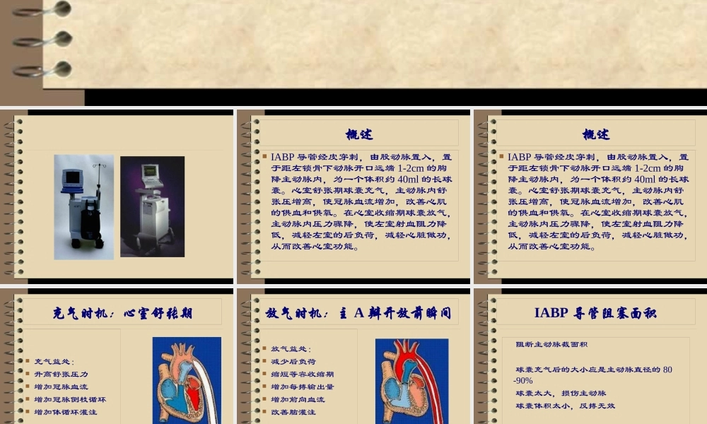 主动脉球囊反搏术.pptx