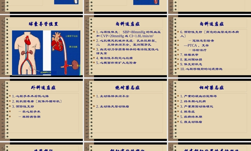 主动脉球囊反搏术.pptx