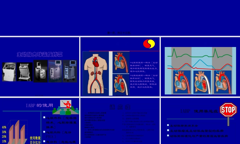 主动脉气囊反搏.pptx