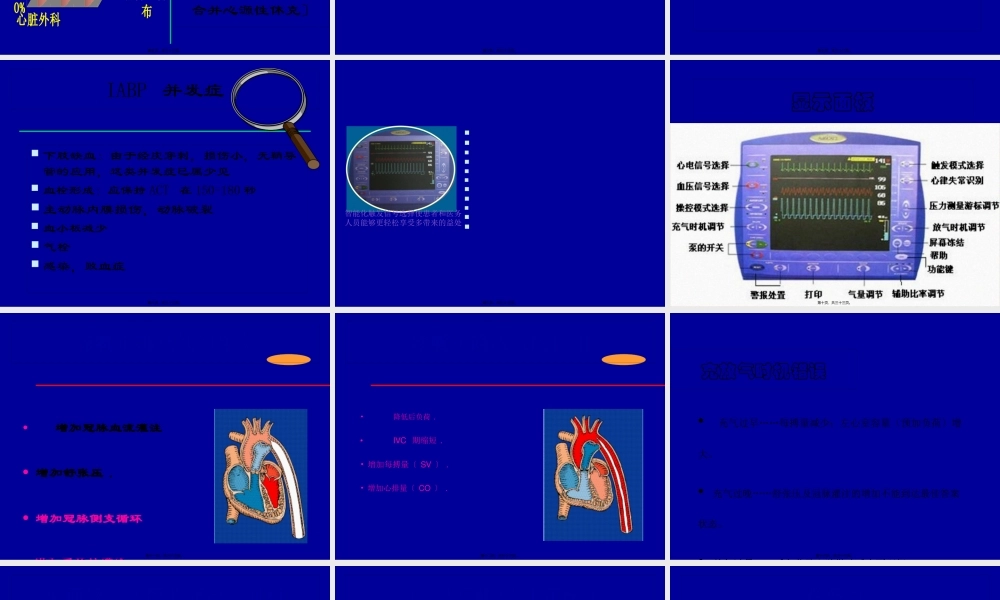 主动脉气囊反搏.pptx