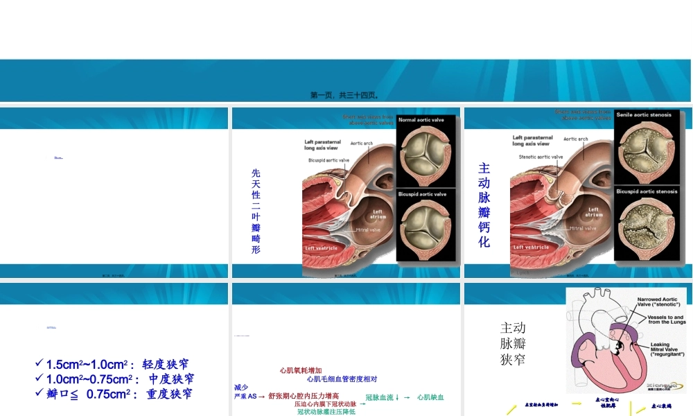 主动脉瓣+肺动脉瓣.ppt
