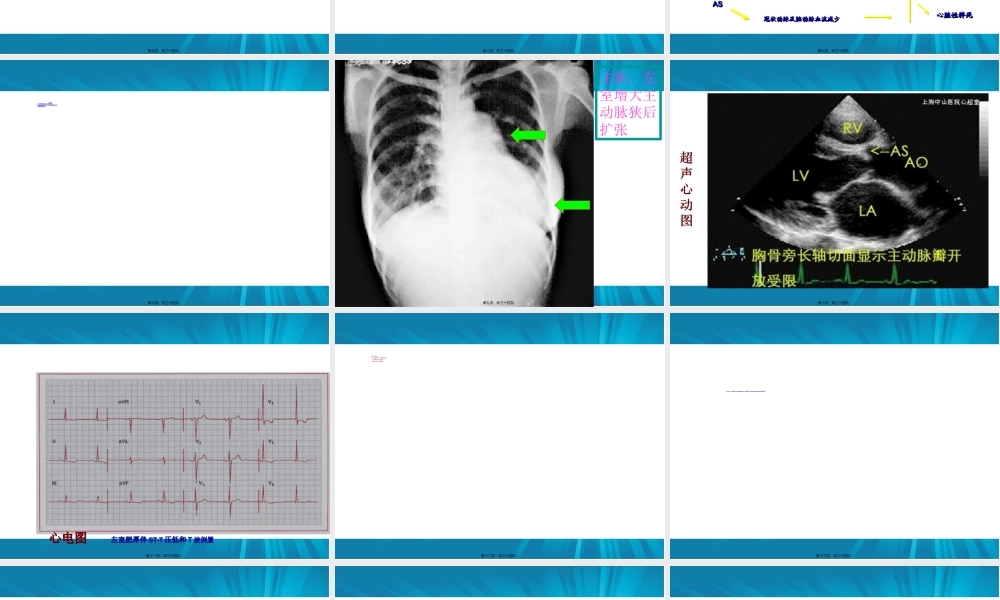 主动脉瓣+肺动脉瓣.ppt