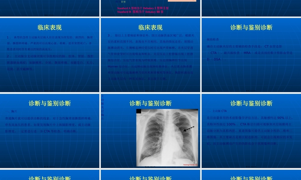 主动脉综合征的诊治.pptx