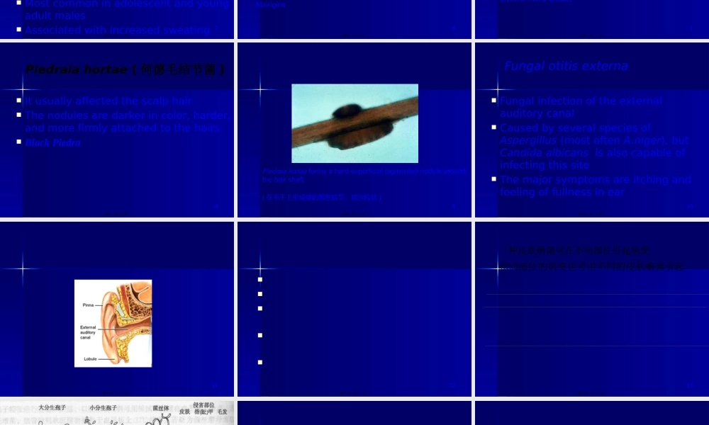 主要致病性真菌.pptx