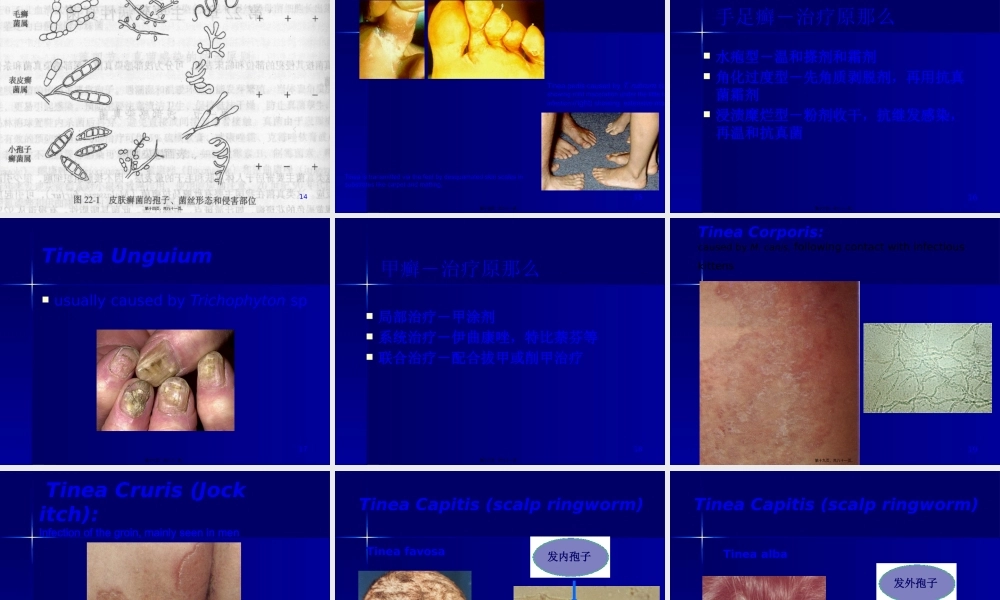 主要致病性真菌.pptx