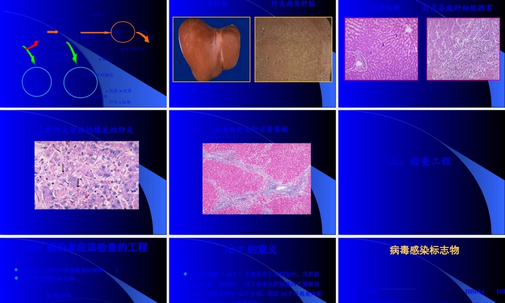乙型肝炎常识.pptx