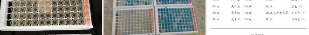 乙肝两对半定性测定.pptx