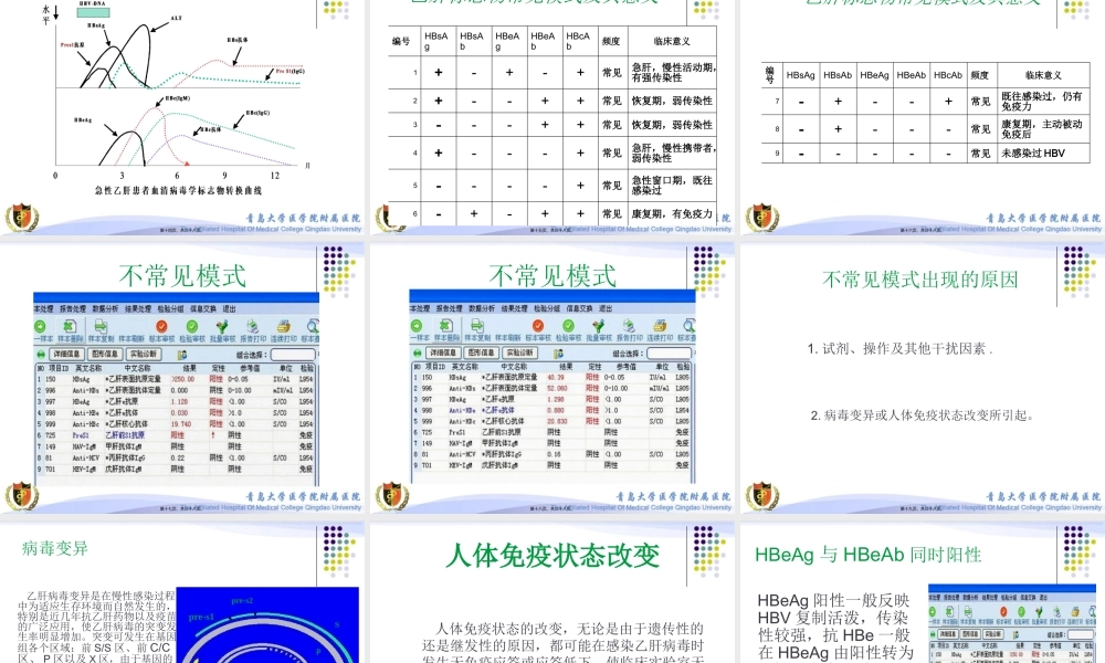 乙肝标志物不常见模式分析.pptx