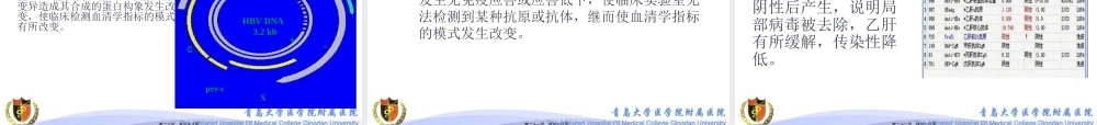 乙肝标志物不常见模式分析.pptx
