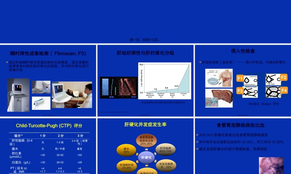 乙肝肝硬化并发症的处理.pptx