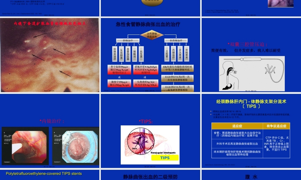 乙肝肝硬化并发症的处理.pptx