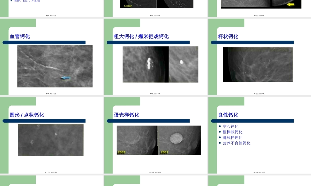 乳腺BI-RADS分级剖析.pptx
