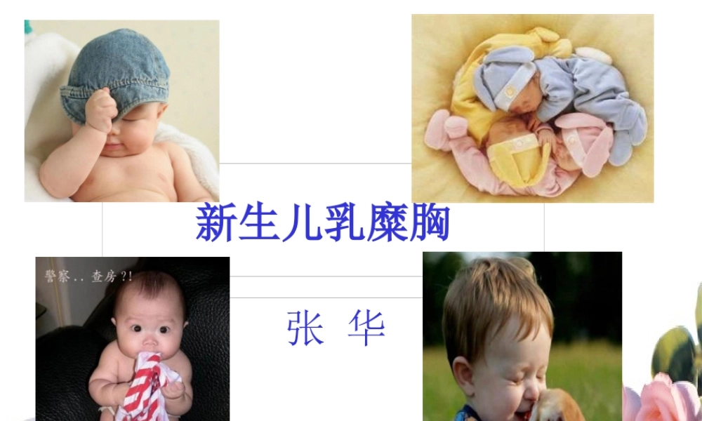 乳糜胸查房.pptx