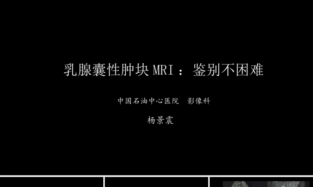 乳腺囊性肿块MRI：鉴别不困难(1).pptx