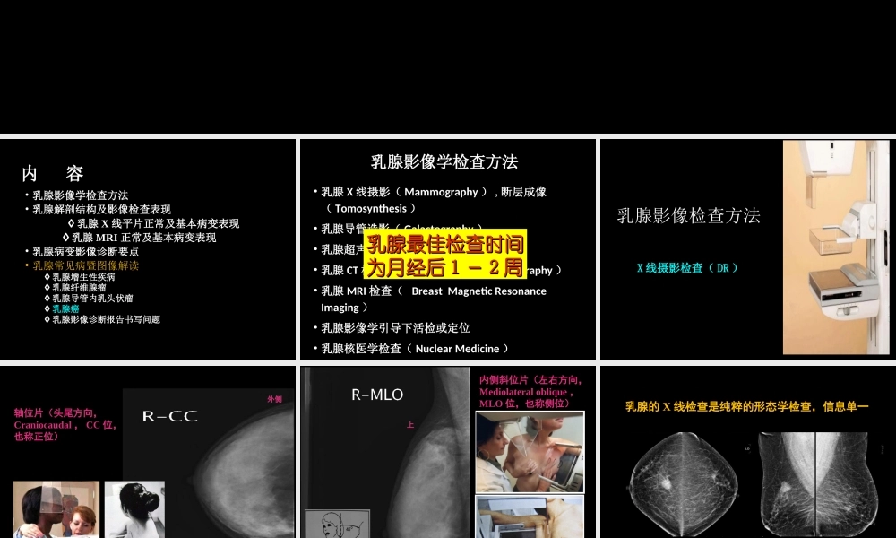 乳腺影像学检查与诊断(1).ppt