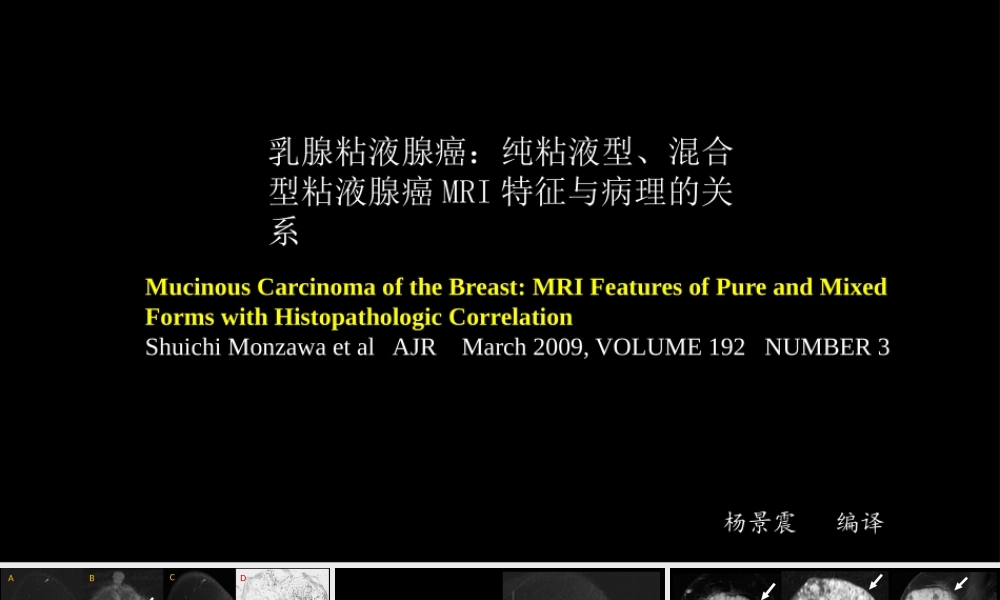 乳腺粘液腺癌MR与病理特点(1).pptx
