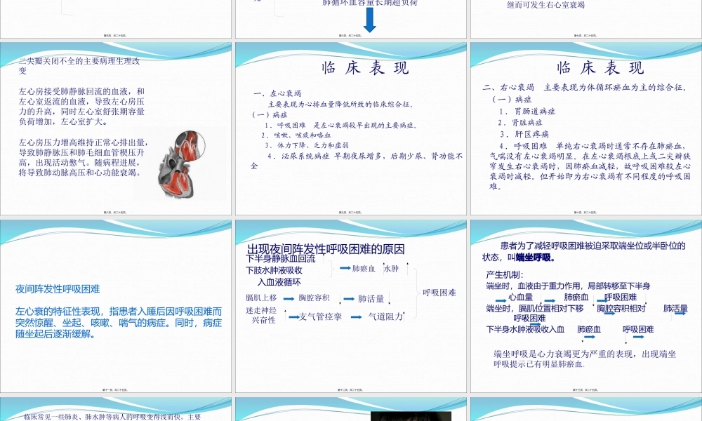 二尖瓣狭窄伴关闭不全导致的症状.pptx