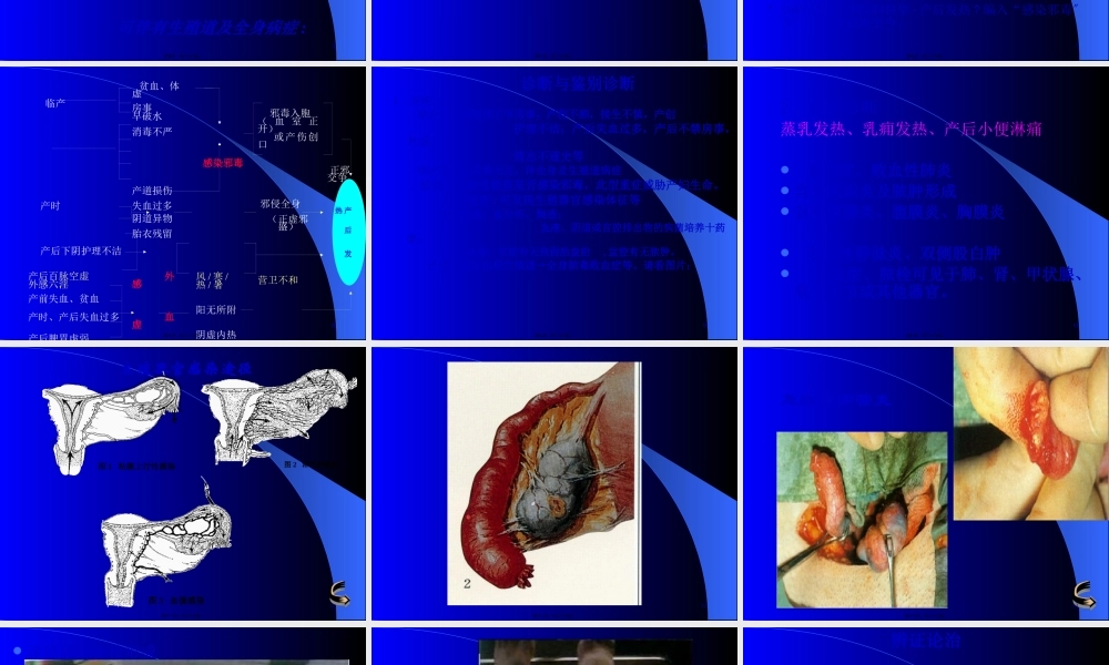 产后发热-吕永贇.pptx