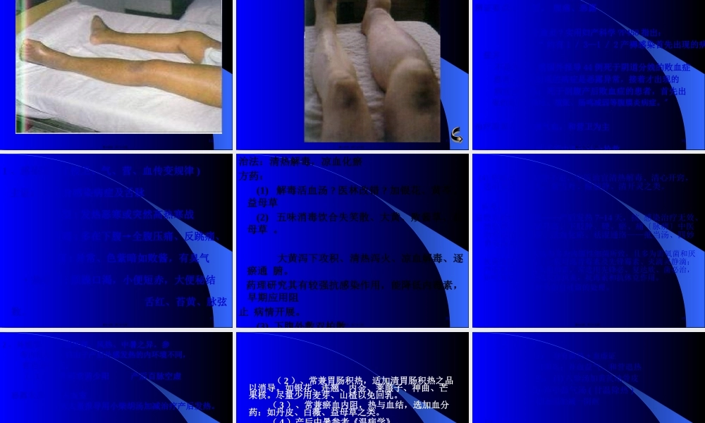 产后发热-吕永贇.pptx