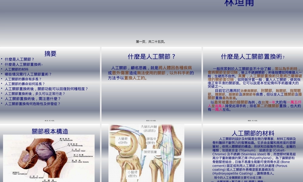 人工关节相关资料.pptx