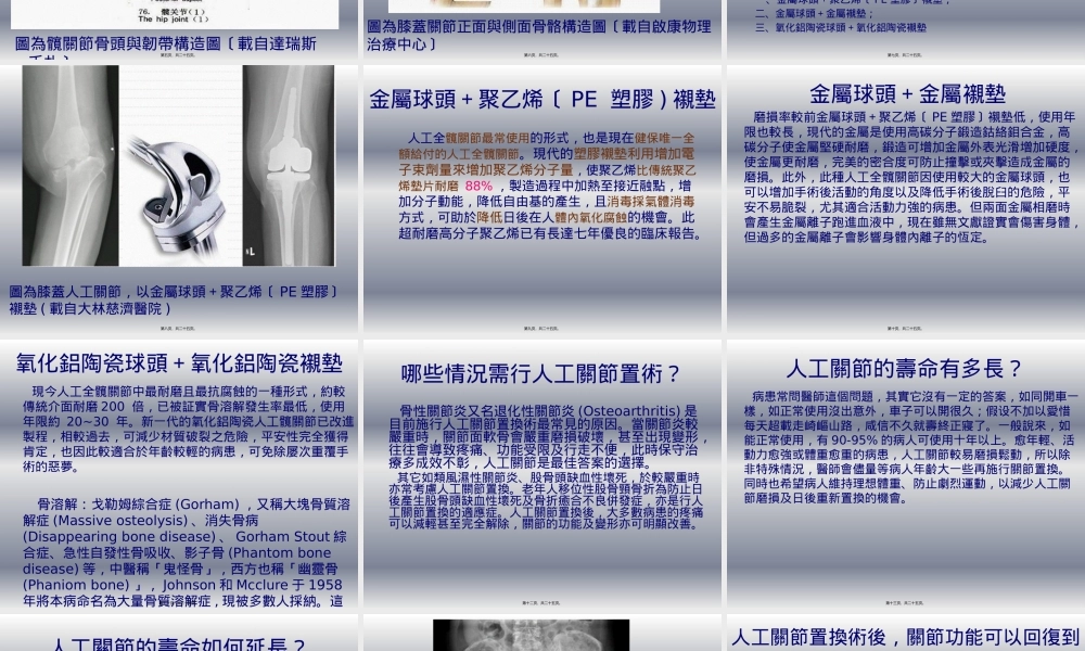 人工关节相关资料.pptx