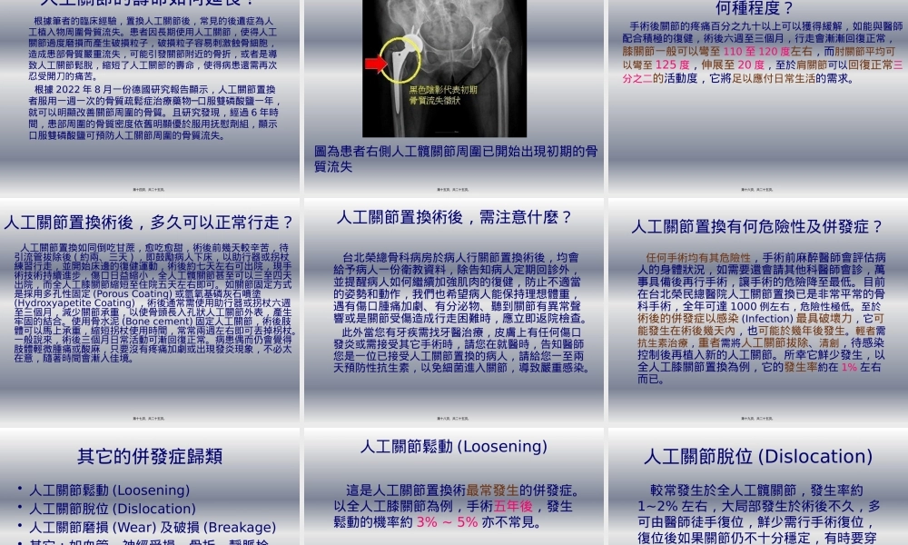 人工关节相关资料.pptx