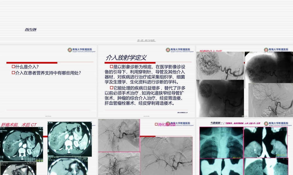 介入技术在患者肠内营养支持中的价值.ppt