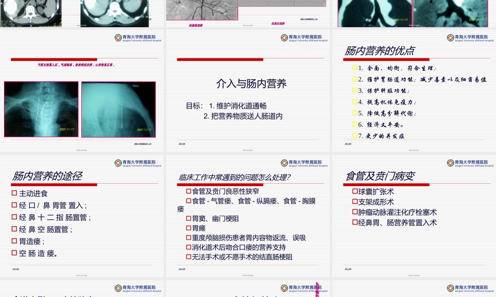 介入技术在患者肠内营养支持中的价值.ppt