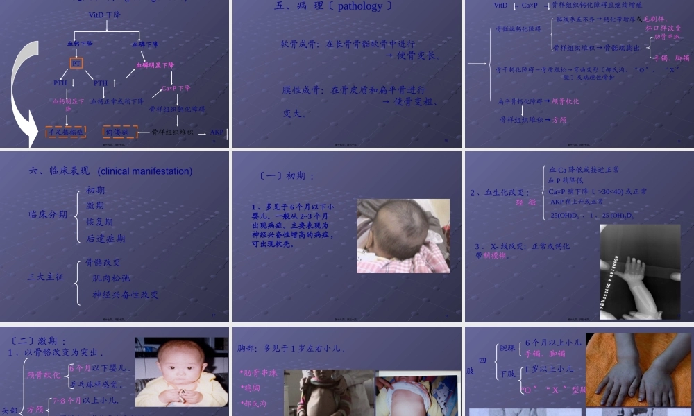 佝偻病(刘英)7年.pptx