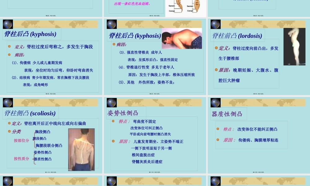 健康评估脊柱四肢.pptx