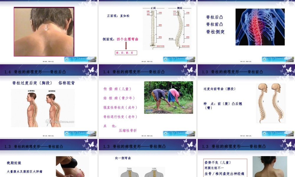 健康评估——脊柱和四肢评估.pptx