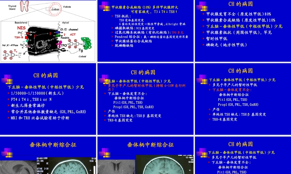 儿童甲低和甲亢(yjs).ppt
