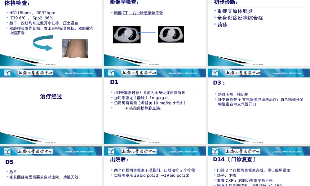 儿童重症肺炎支原体肺炎.pptx
