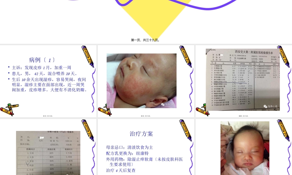 儿童过敏病例分享.pptx